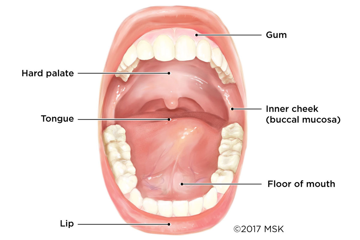 Ung thư miệng: Nhận diện, nguyên nhân và phương pháp điều trị