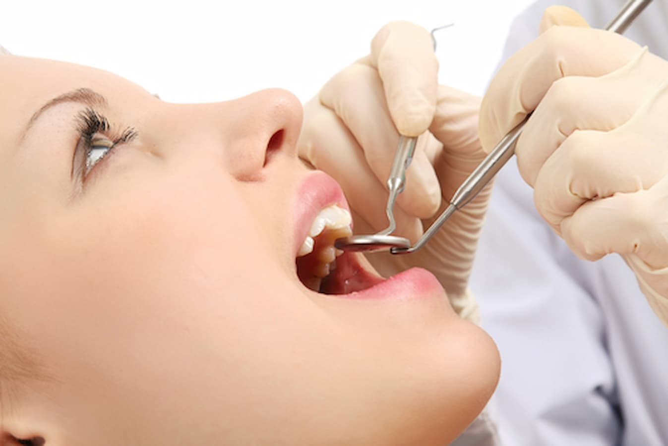 Vật liệu trám răng Amalgam: Lợi ích, rủi ro và tương lai